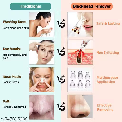 Deep Clean Pore Vacuum Blackhead Remover | Clear Skin at Home in Minutes